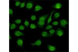 Immunocytochemistry staining of HeLa cells fixed with 4 % Paraformaldehyde and using anti-NFIC mouse mAb (dilution 1:200).