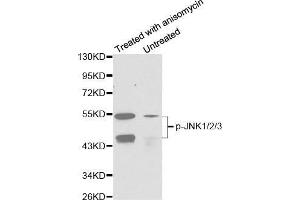 Western blot analysis of extracts from C6 cells untreated or treated with anisomycin using Phospho-MAPK8/9/10-T183/Y185 Antibody. (MAPK8/9/10 anticorps  (pThr221, pTyr223))