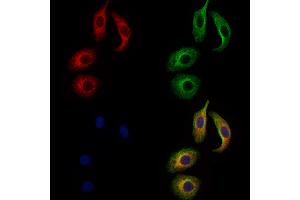 ABIN7094617 and ABIN7098667 staining Hela cells by IF/ICC.