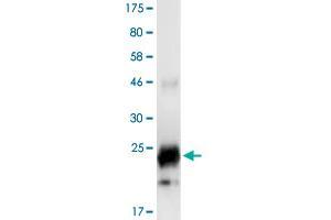 Image no. 2 for Tumor Necrosis Factor (Ligand) Superfamily, Member 14 (TNFSF14) (AA 89-240) protein (His-DYKDDDDK-Strep II Tag) (ABIN1323228)