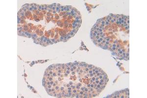 Used in DAB staining on fromalin fixed paraffin- embedded Kidney tissue