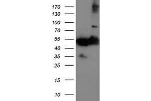 Western Blotting (WB) image for anti-Tubulin, alpha-Like 3 (TUBAL3) (AA 150-446) antibody (ABIN1490957) (TUBAL3 anticorps  (AA 150-446))