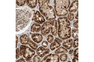 Immunohistochemical staining of human kidney with CPAMD8 polyclonal antibody  shows strong cytoplasmic positivity in cells of tubules at 1:10-1:20 dilution. (CPAMD8 anticorps)
