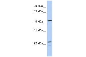 WB Suggested Anti-BCKDHA Antibody Titration: 0. (BCKDHA anticorps  (N-Term))