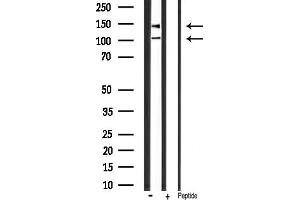 anti-Insulin-Like Growth Factor 1 Receptor (IGF1R) (pTyr1165), (pTyr1166) antibody