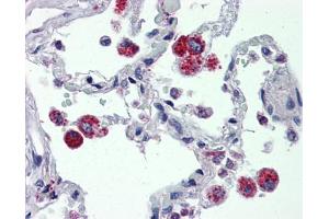IHC Information: Lung, Human: Formalin-Fixed, Paraffin-Embedded (FFPE) (CYBB anticorps  (C-Term))