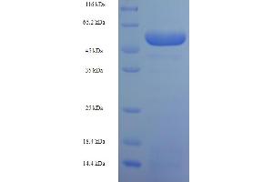 SDS-PAGE (SDS) image for Squamous Cell Carcinoma Antigen Recognized By T Cells 3 (SART3) (AA 600-900), (partial) protein (His-SUMO Tag) (ABIN5711337)