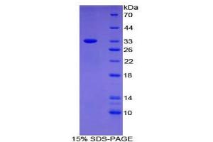 SDS-PAGE analysis of Human AE1 Protein.