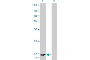 Western Blot analysis of FABP1 expression in transfected 293T cell line by FABP1 monoclonal antibody (M02), clone 5F7.