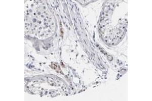 Immunohistochemical staining of human testis with CATSPERD polyclonal antibody  shows moderate cytoplasmic positivity in Leydig cells at 1:50-1:200 dilution. (TMEM146 anticorps)