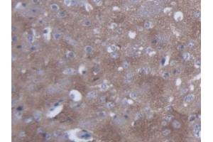 DAB staining on IHC-P; Samples: Mouse Cerebrum Tissue