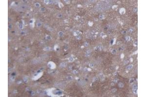 DAB staining on IHC-P; Samples: Mouse Cerebrum Tissue