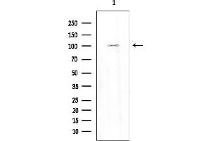 Western blot analysis of lysates from K562 cells(heat-shock treatment), using ACK1 Mouse Monoclonal Antibody at 1/1000 dilution.