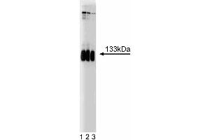 Western blot analysis of mGluR1 on a rat cerebrum lysate. (Metabotropic Glutamate Receptor 1 anticorps  (AA 1042-1160))