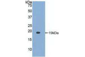 Detection of Recombinant FABP9, Human using Polyclonal Antibody to Fatty Acid Binding Protein 9, Testis (FABP9) (FABP9 anticorps  (AA 1-132))
