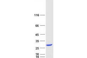 Validation with Western Blot