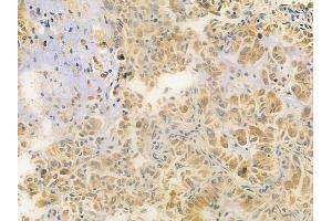 anti-Serine/threonine-Protein Kinase PRKY (PRKY) antibody