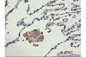 Immunohistochemistry (IHC) image for anti-ATP/GTP Binding Protein 1 (AGTPBP1) (AA 368-753) antibody (ABIN1491460)