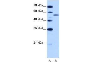 WB Suggested Anti-ZRSR2 Antibody Titration:  2.
