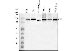 Western blot analysis of ITGA5 using anti-ITGA5 antibody (ABIN5693202).