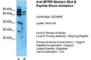 Host: Rabbit  Target Name: MTRR  Sample Tissue: HelaLane A:  Primary Antibody Lane B:  Primary Antibody + Blocking Peptide Primary Antibody Concentration: 1 µg/mL Peptide Concentration: 5. (MTRR anticorps  (N-Term))