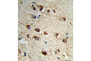 Formalin-fixed and paraffin-embedded human brain tissue reacted with Fibromodulin Antibody (C-term) followed which was peroxidase-conjugated to the secondary antibody, followed by DAB staining. (Fibromodulin anticorps  (C-Term))