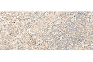 Immunohistochemistry of paraffin-embedded Human tonsil tissue using RGR Polyclonal Antibody at dilution of 1:25(x200) (RGR anticorps)