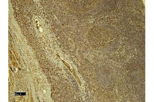 (ABIN5539581) (8 μg/mL) staining of paraffin embedded Human Tonsil.