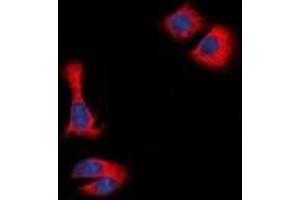 Immunofluorescent analysis of STMN1 staining in Hela cells. (Stathmin 1 anticorps  (N-Term))