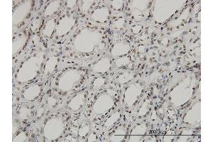 Immunoperoxidase of monoclonal antibody to SGK on formalin-fixed paraffin-embedded human kidney. (SGK1 anticorps  (AA 1-431))