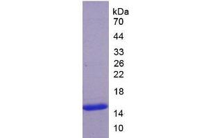 SDS-PAGE analysis of Human ADAMTS7 Protein. (ADAMTS7 Protéine)
