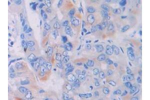 Used in DAB staining on fromalin fixed paraffin- embedded liver tissue (LGALS9B anticorps  (AA 17-148))