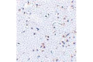 Immunohistochemistry of TSLP in human brain tissue with TSLP polyclonal antibody  at 2. (Thymic Stromal Lymphopoietin anticorps  (C-Term))
