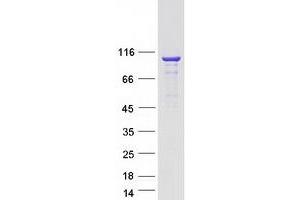 Validation with Western Blot