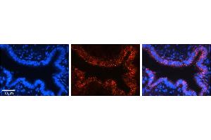 Rabbit Anti-VDAC2 Antibody     Formalin Fixed Paraffin Embedded Tissue: Human Bronchial Epithelial Tissue  Observed Staining: Cytoplasmic  Primary Antibody Concentration: 1:100  Secondary Antibody: Donkey anti-Rabbit-Cy3  Secondary Antibody Concentration: 1:200  Magnification: 20X  Exposure Time: 0.