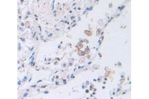 IHC-P analysis of Human Tissue, with DAB staining. (PTGER2 anticorps  (AA 155-355))