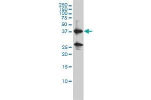 REN monoclonal antibody (M01), clone 2H2 Western Blot analysis of REN expression in K-562 . (Renin anticorps  (AA 24-406))