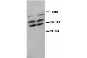 Image no. 2 for anti-Protein Phosphatase 2, Catalytic Subunit, alpha Isozyme (PPP2CA) (N-Term) antibody (ABIN1495037) (PPP2CA anticorps  (N-Term))