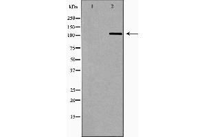 Western blot analysis of Hela whole cell lysates, using OGT Antibody. (OGT anticorps  (N-Term))