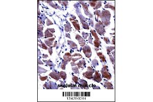 DPYSL3 Antibody immunohistochemistry analysis in formalin fixed and paraffin embedded human skeletal muscle followed by peroxidase conjugation of the secondary antibody and DAB staining. (DPYSL3 anticorps  (C-Term))