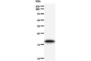 Western Blotting (WB) image for anti-Twist Homolog 1 (Drosophila) (TWIST1) antibody (ABIN933111) (TWIST1 anticorps)