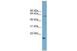 WB Suggested Anti-ZNF83 Antibody Titration:  0. (ZNF83 anticorps  (N-Term))