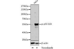 Western blot analysis of extracts of HT-29 cells using Phospho-p53(S33) Polyclonal Antibody at dilution of 1:2000. (p53 anticorps  (pSer33))