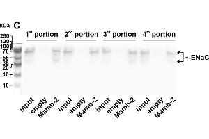 Whole membranes used for the analysis of the molecular targets extracted by mambalgin-2 from membrane fraction of A549 cells.