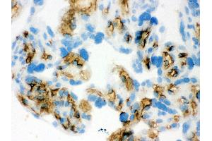 Anti- Band 3 Picoband antibody,IHC(F) IHC(F): Human Placenta Tissue (Band 3/AE1 anticorps  (AA 28-365))