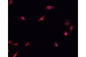 ABIN6266706 staining K-562 cells by IF/ICC. (T-Box 1 anticorps  (C-Term))