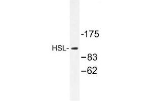 Image no. 1 for anti-Lipase, Hormone-Sensitive (LIPE) antibody (ABIN317711) (LIPE anticorps)
