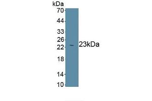 Detection of Recombinant Smad3, Human using Monoclonal Antibody to SMAD family member 3 (SMAD3) (SMAD3 anticorps  (AA 231-425))