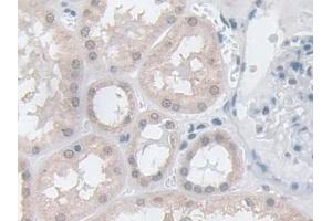 Detection of GPX3 in Human Kidney Tissue using Polyclonal Antibody to Glutathione Peroxidase 3, Plasma (GPX3)