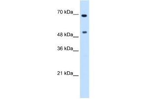 WB Suggested Anti-MYC Antibody Titration:  0. (c-MYC anticorps  (N-Term))